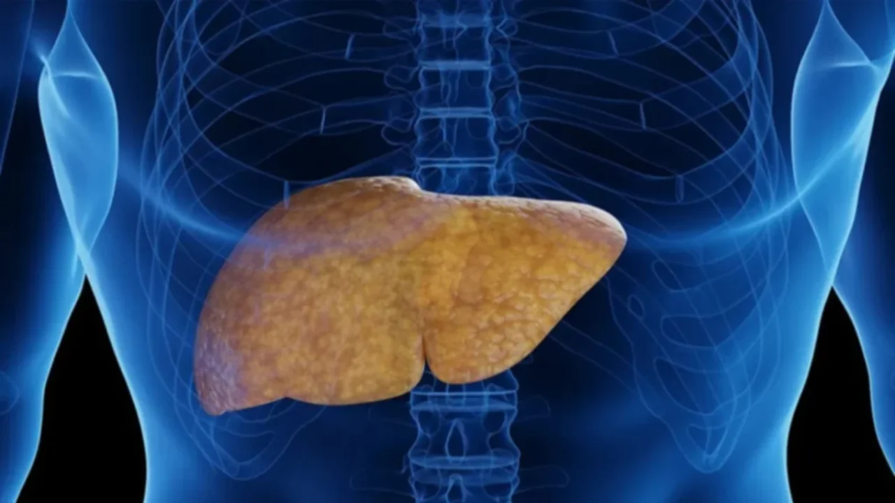 Hígado graso: Limpialo de manera natural con esta infusión