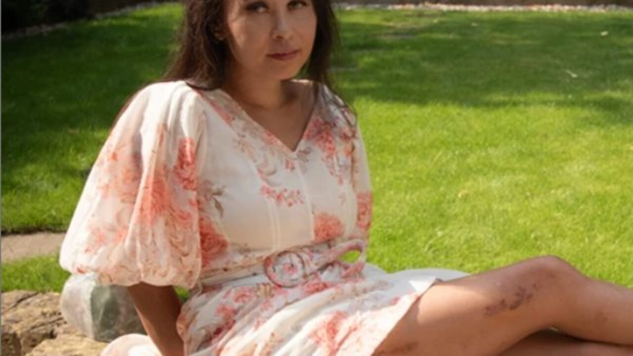 Elaine Foo me operé para alargar mis piernas y todo salió terriblemente mal