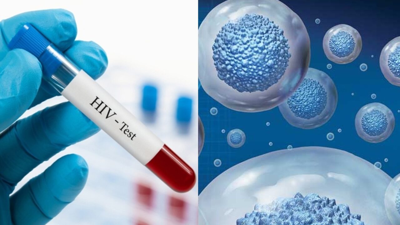 El «milagro» de la ciencia llega al paciente diez: Una nueva curación del VIH sacude la medicina mundial