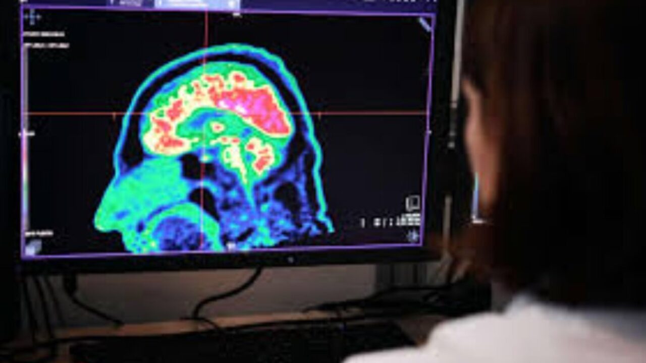 Según estudios la grasa abdominal oculta está relacionada con la inflamación cerebral y la demencia