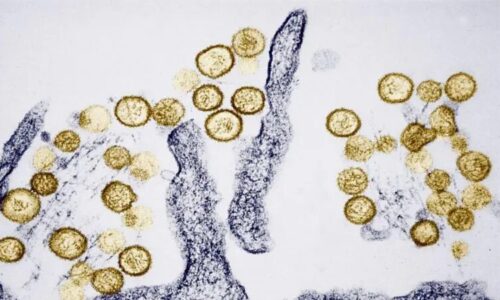 Ministerio de Salud confirma hantavirus en Anzoátegui tras decesos y descarta nexo con casos en Barinas