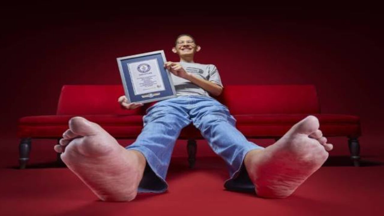 El venezolano con los pies más grandes del mundo necesita una ayuda